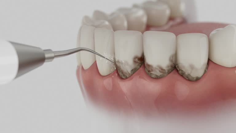 Reliable Dental Implants contractor in Stanton, MI by Smile Center Dentistry